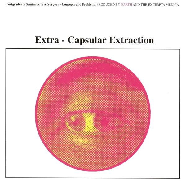 Extra-capsular-extraction-5209ffe2bd0df